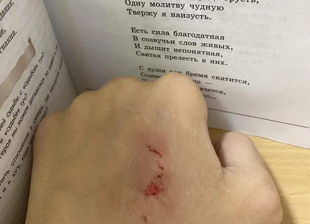 Укусишь за рифму? Поговорим!